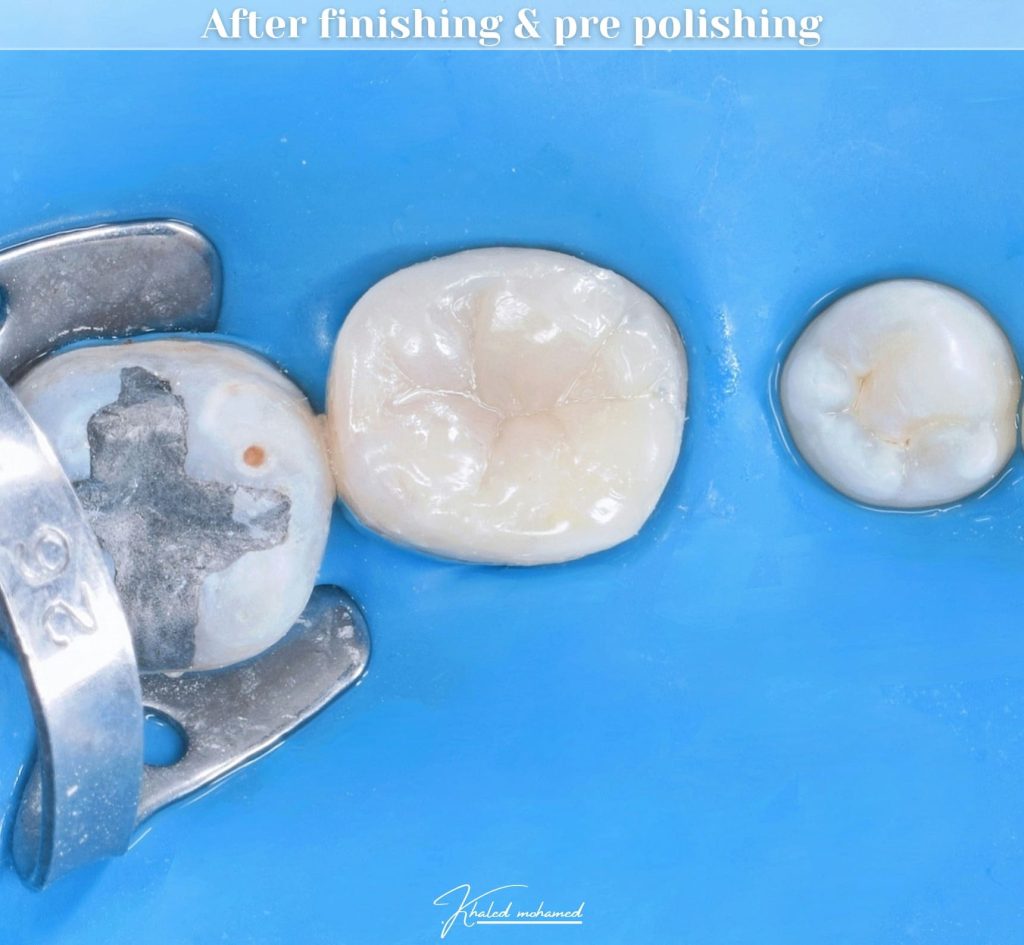 Polishing with kinda kit