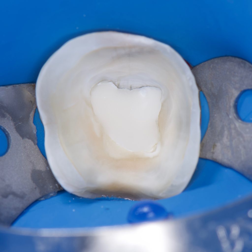 515B6173-CACC-42F3-8CD9-7DCA47D9B532