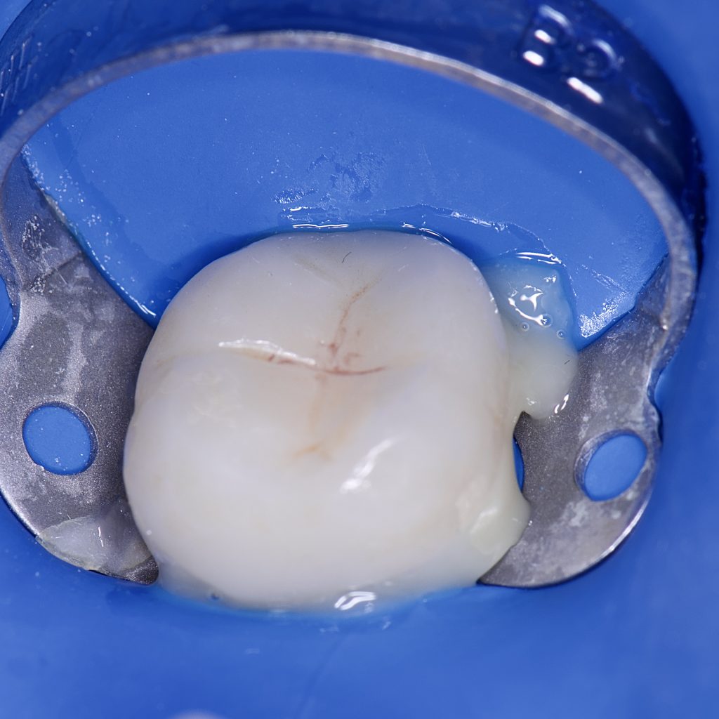 7B0D4033-C527-4956-A63F-93CD4561CD9B