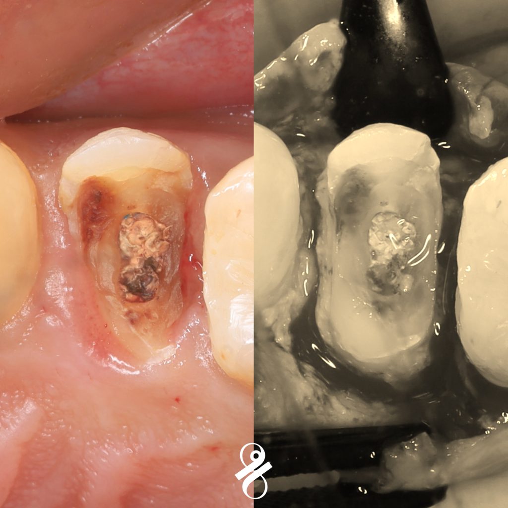 DFB52B13-8E86-4ADC-9AF7-2CB49A4BE44D