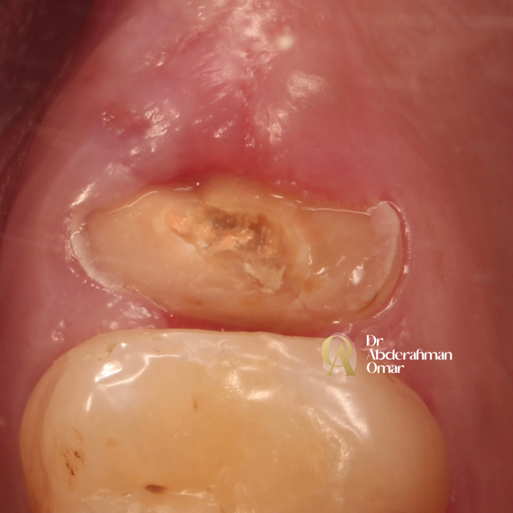 Dr abdelrahman.zip - 1