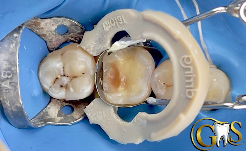 1BC14918-0FEF-4963-9DB7-F2985D641516