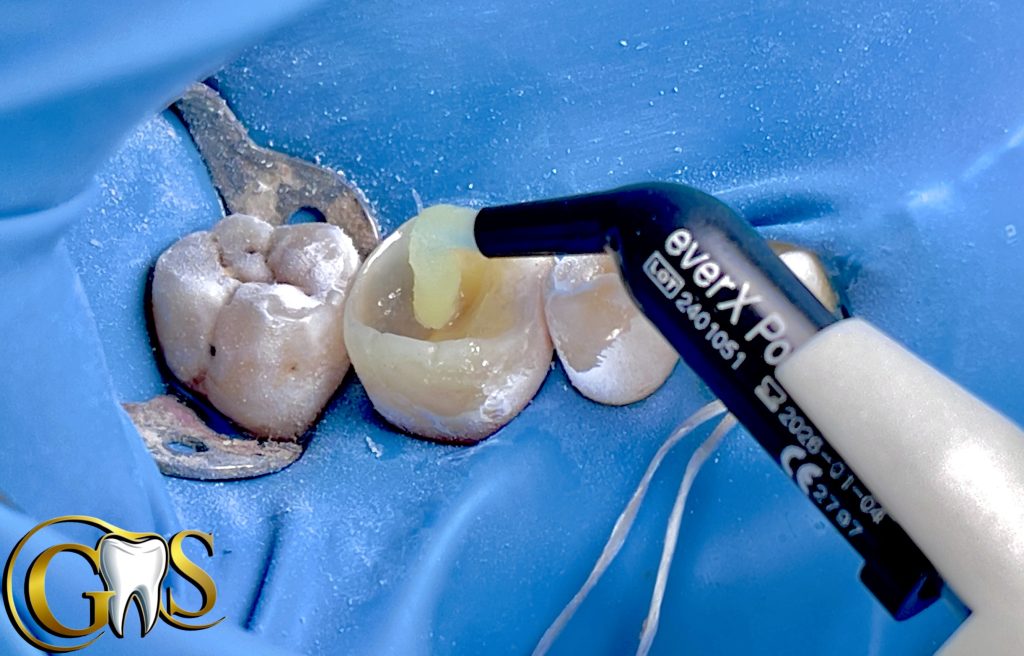 1CE5FAFF-17AC-4F65-AE5E-26C3F6CFB1D9