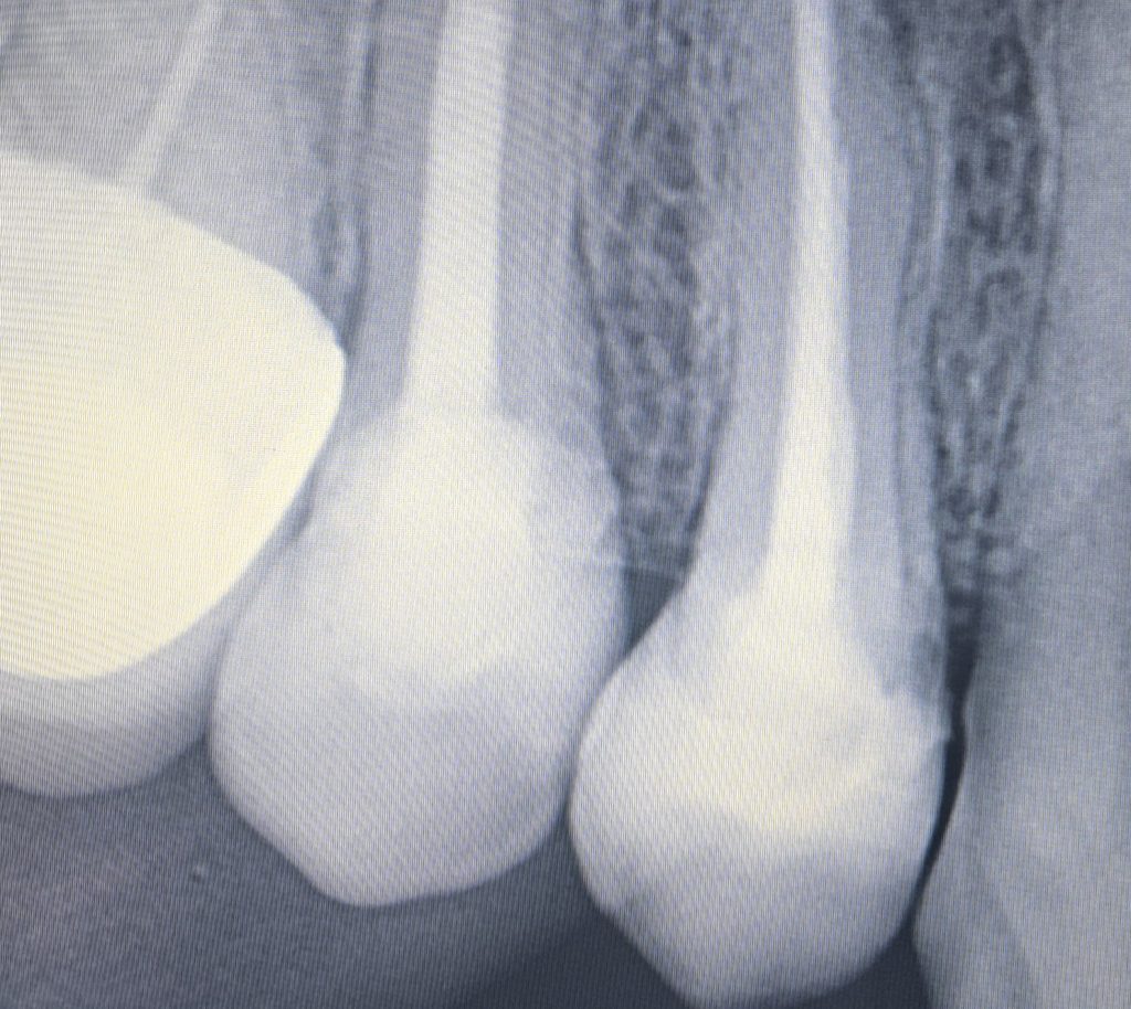 20250417_194918_resized