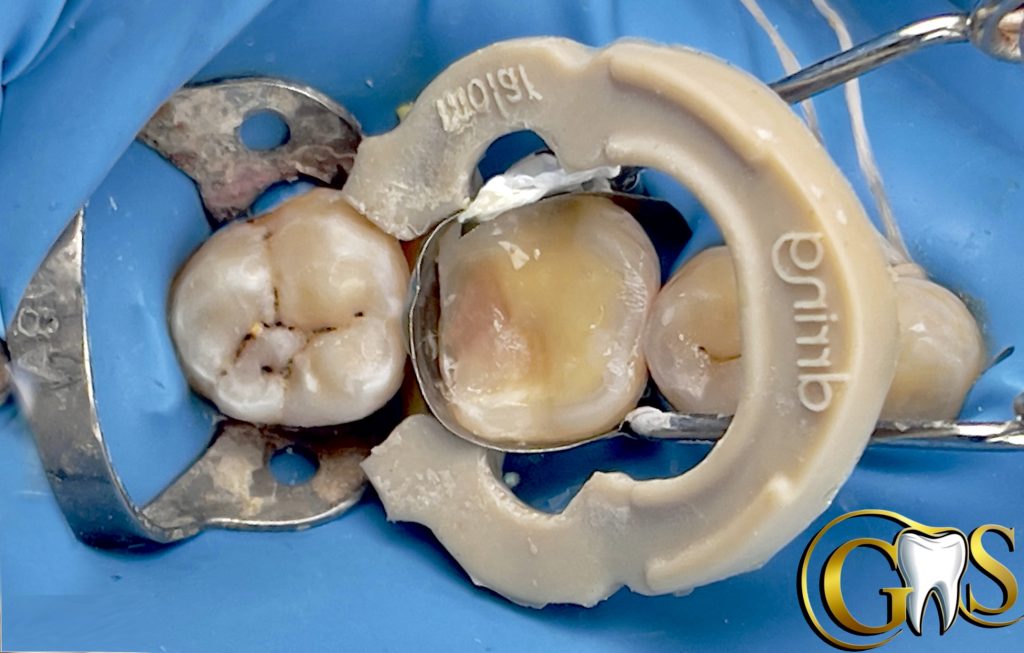 3655D18A-3520-4FDF-964F-F809DFAE2F13