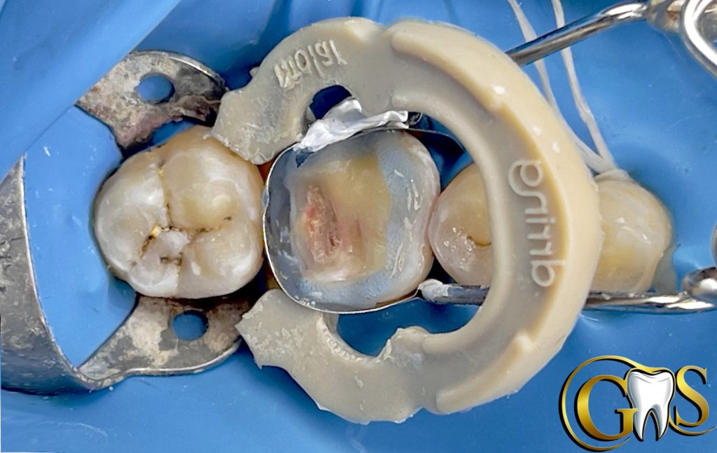 52B783B2-AB5D-4B3B-813D-C6594DA4FDB2