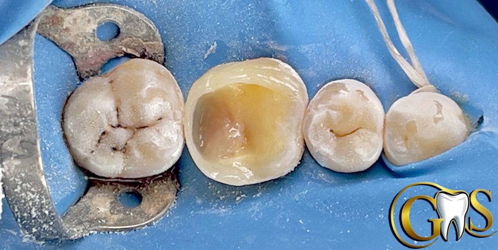 546FC579-4F0C-400D-9D00-38A89DFC2322