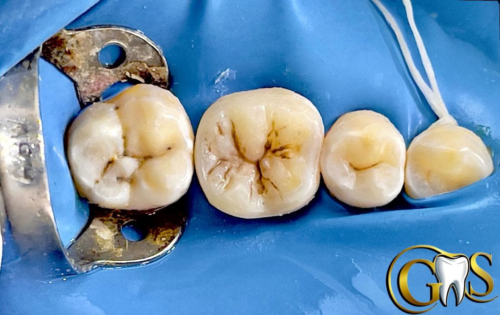 8383A351-CC33-48BF-A186-539375576836