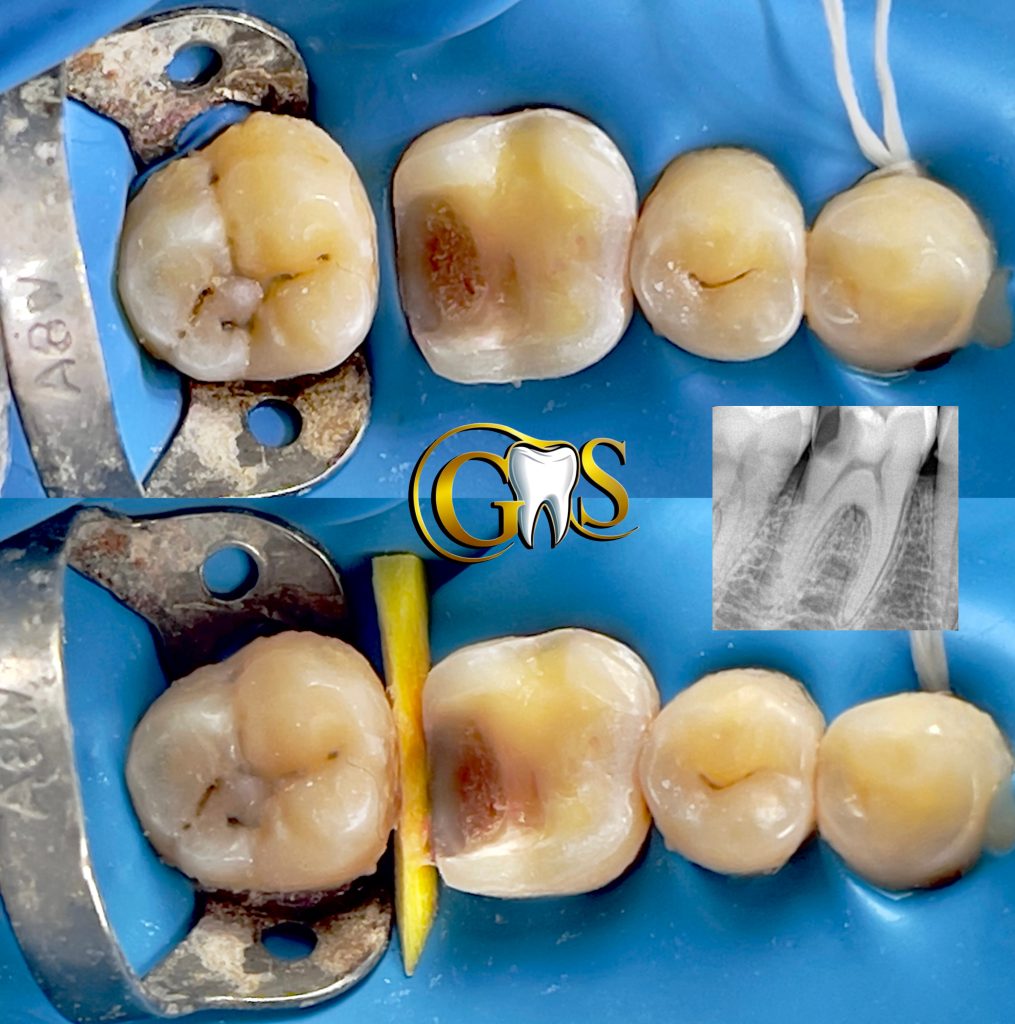 ACE775C5-A9EF-4D38-87E3-FE18F9A12EF8