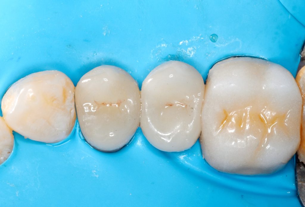 B612_20250424_204455_138