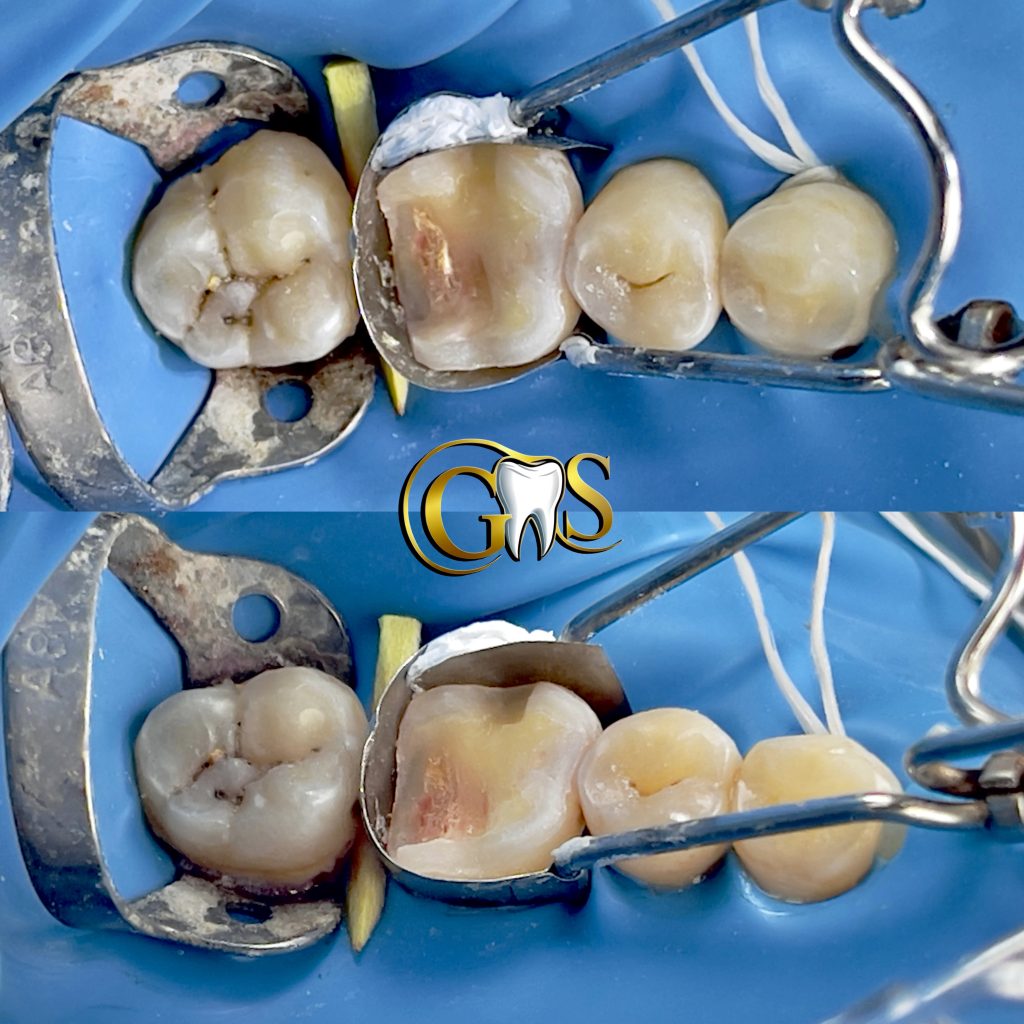 BB0848C6-381B-4617-9FA3-0FA404F2DC00