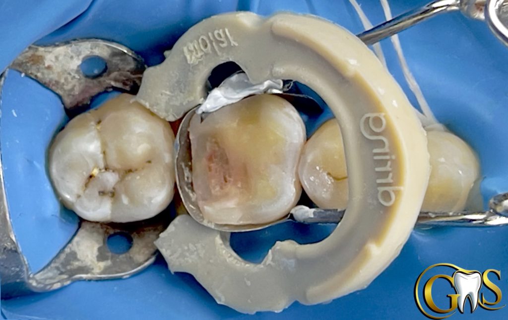 C51106F8-13C9-4D7F-A2CF-D96C2C304AEF