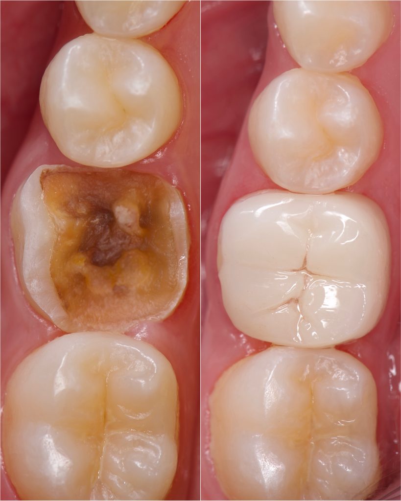 CE8A6CA6-A34A-453D-86D7-9464B08C5FD3