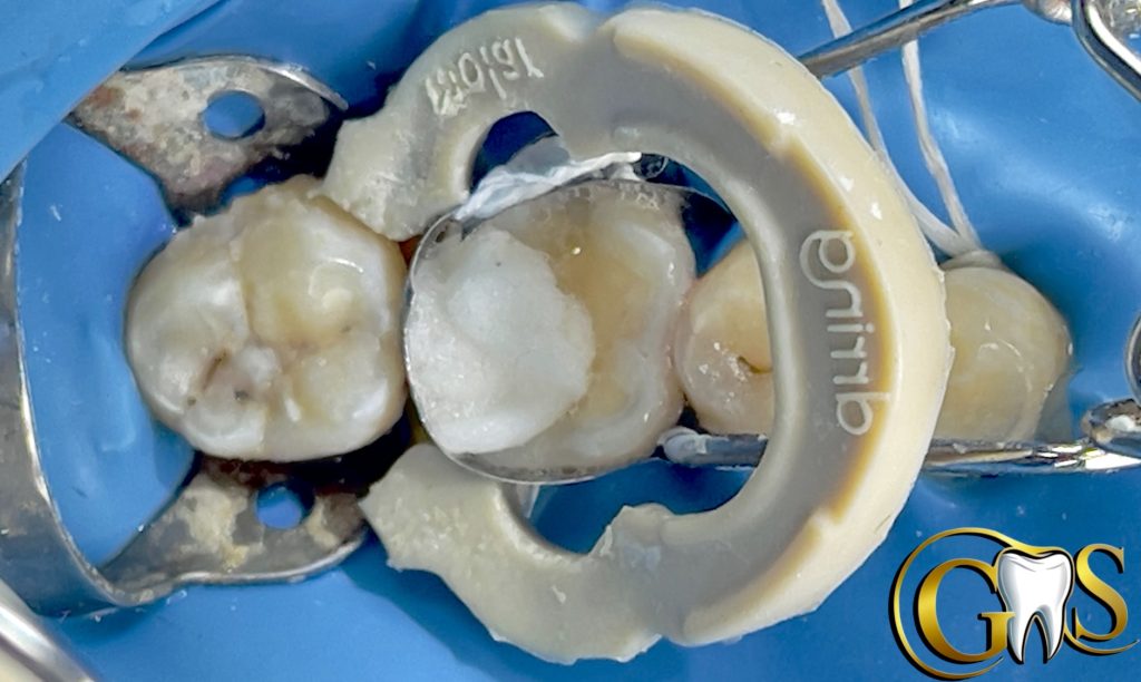 DB69F641-B107-4124-A8C6-5E38EC02D5D0