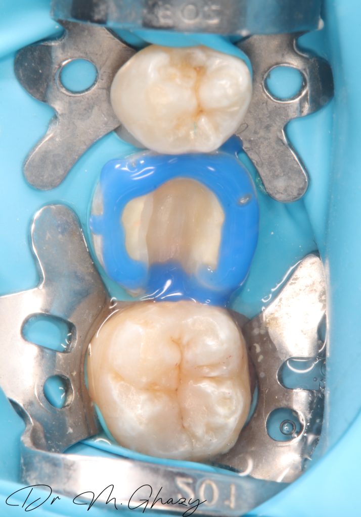 Picsart_24-12-19_01-43-44-645