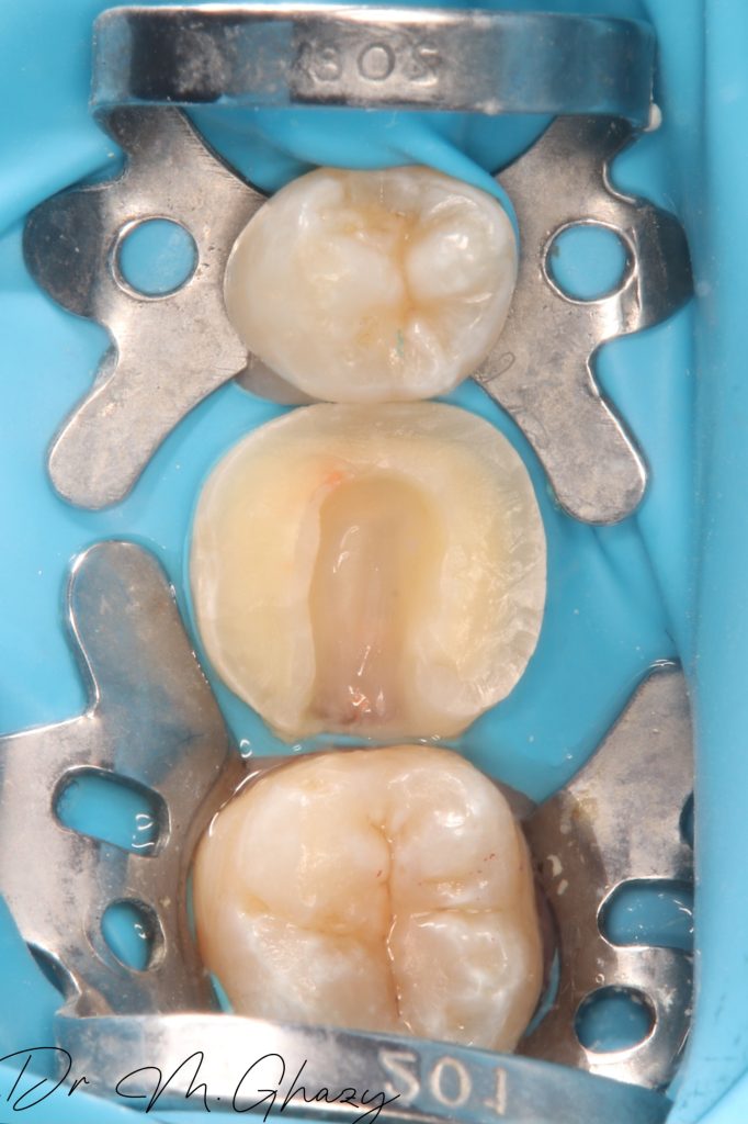 Picsart_24-12-19_01-51-05-305