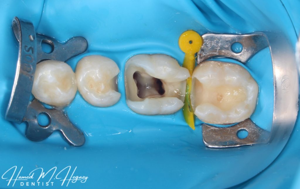 Picsart_25-03-03_17-01-03-802