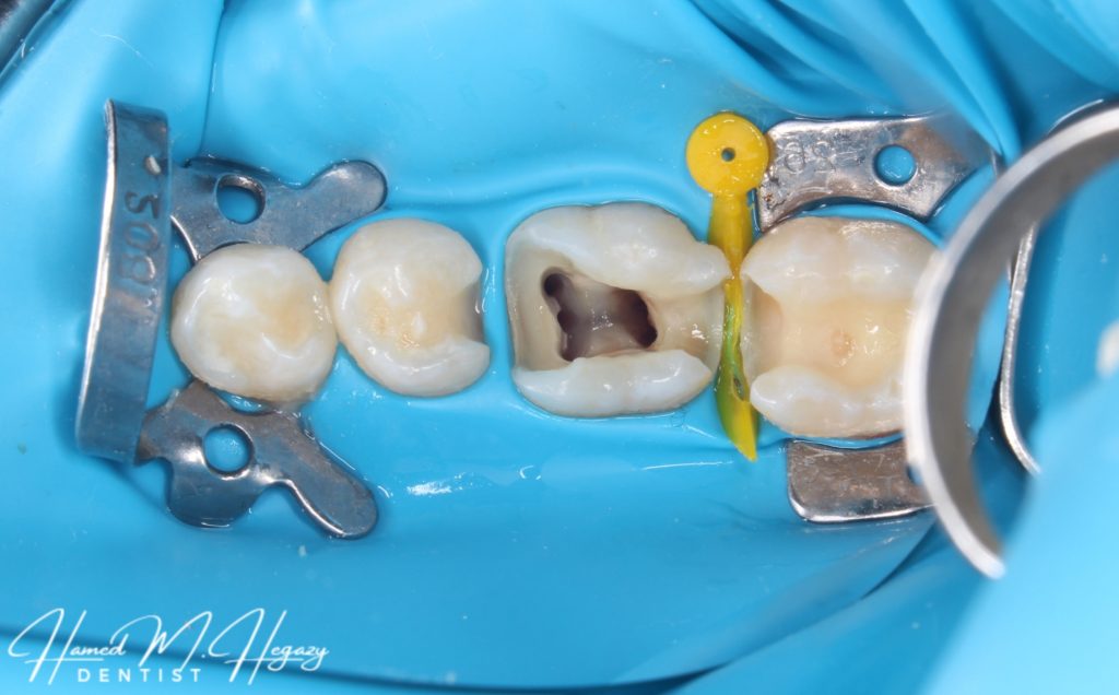 Picsart_25-03-03_17-08-07-921