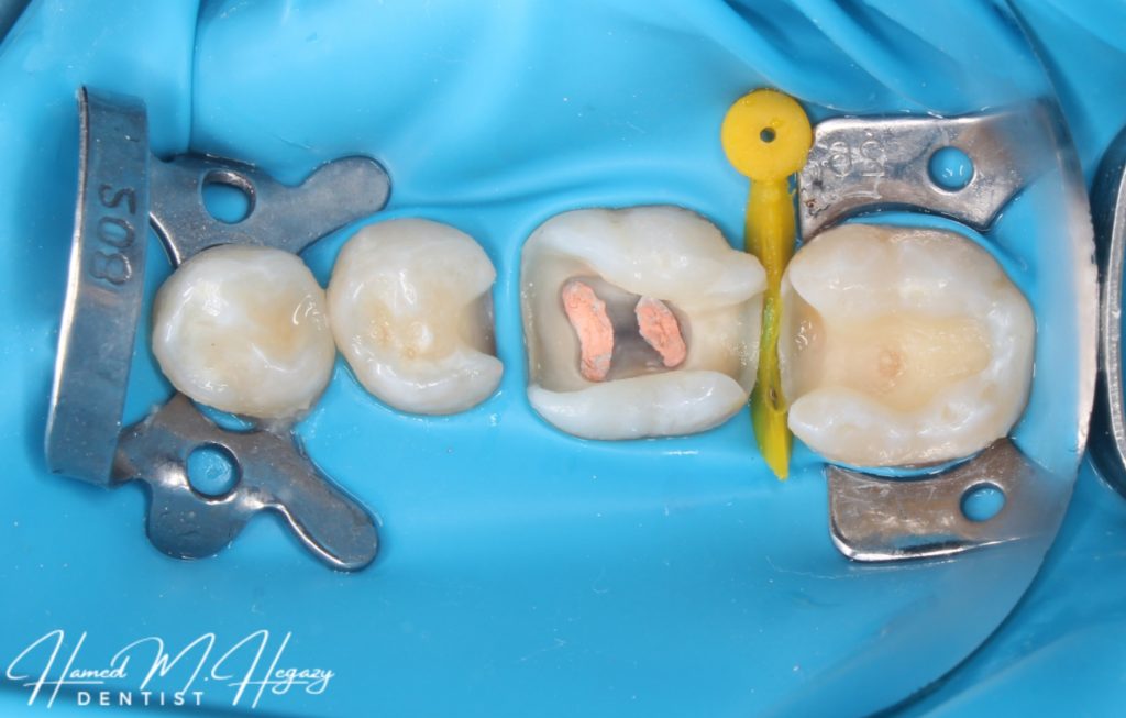 Picsart_25-03-03_17-09-53-386