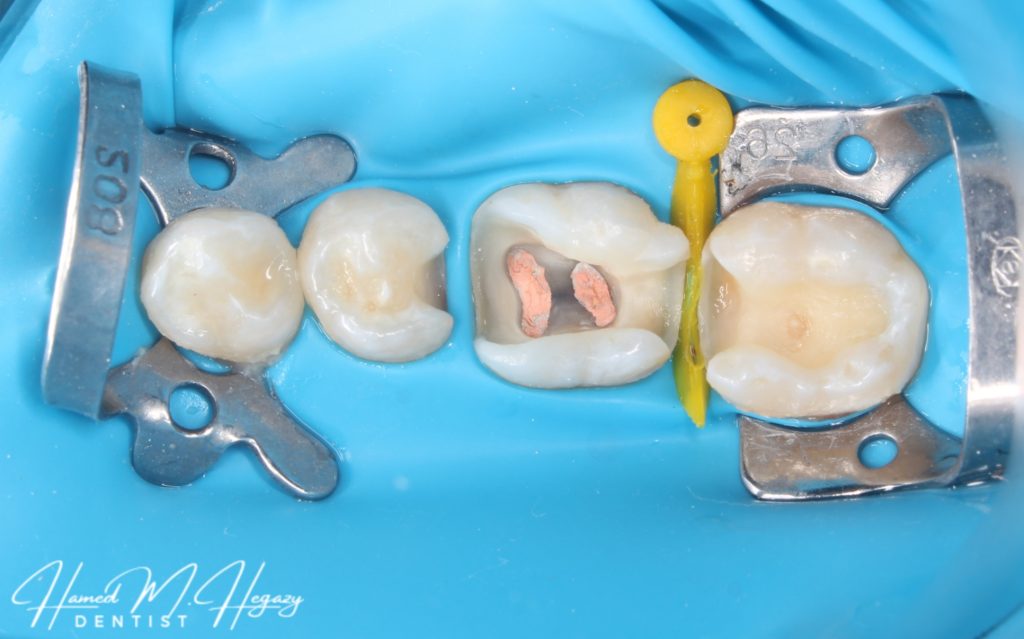 Picsart_25-03-03_17-16-53-171