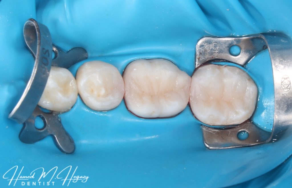 Picsart_25-03-03_17-20-16-512