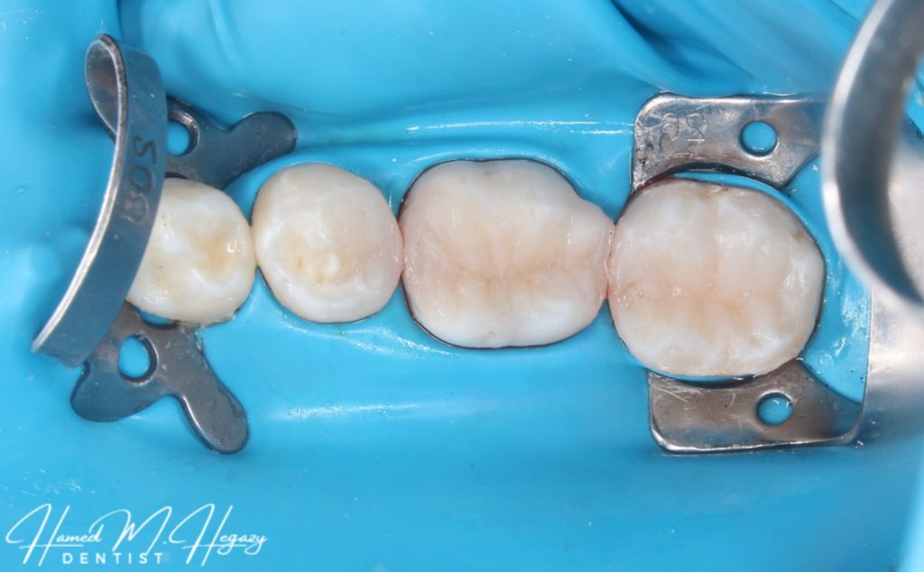 Picsart_25-03-03_17-22-36-625