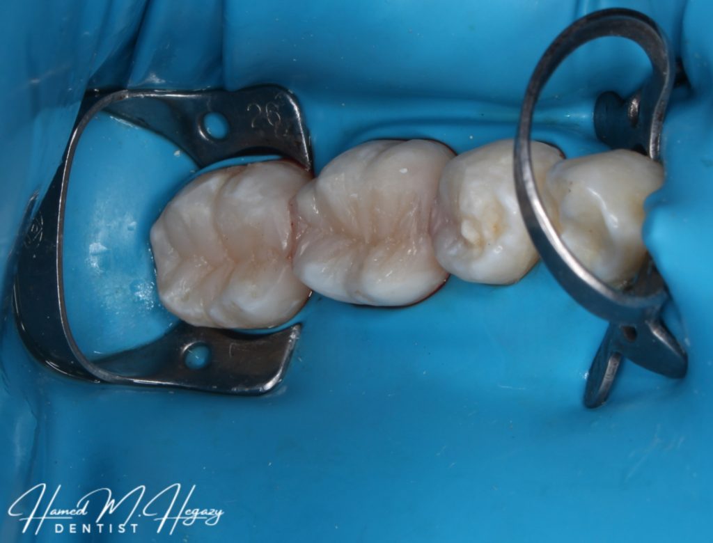 Picsart_25-03-03_17-25-53-367