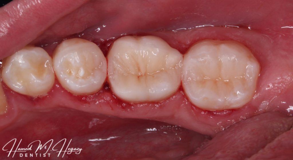 Picsart_25-03-03_17-32-28-706