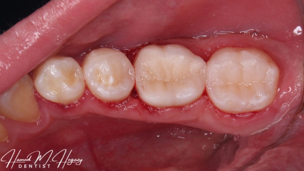 Picsart_25-03-03_17-36-20-723