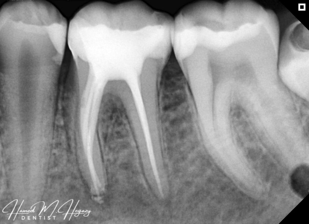 Picsart_25-03-03_17-58-59-701