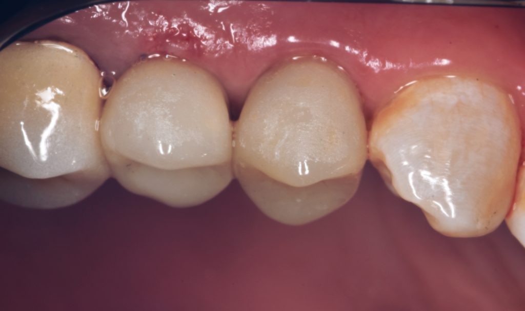 Picsart_25-04-24_20-26-12-244