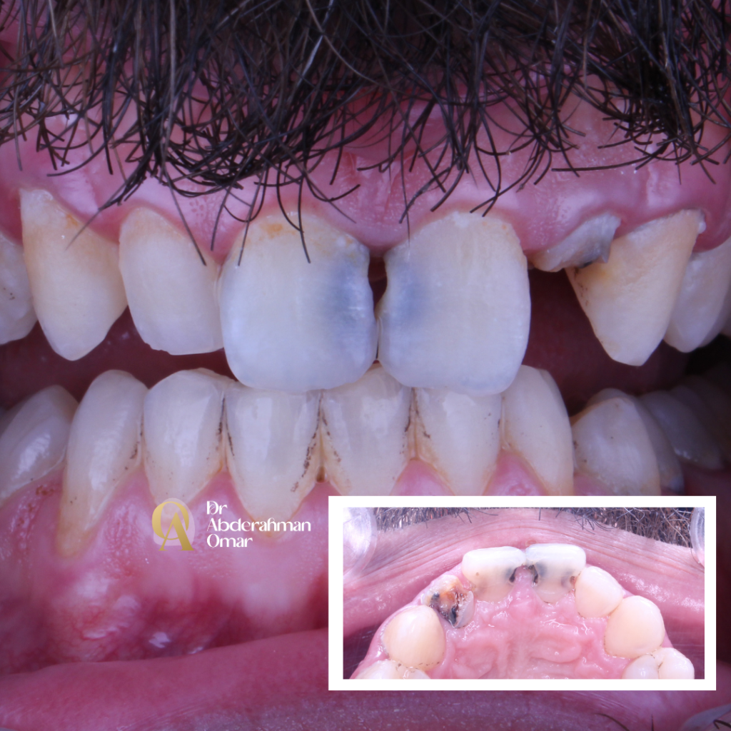 Dr abdelrahman.zip - 75