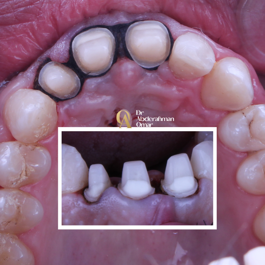 Dr abdelrahman.zip - 80