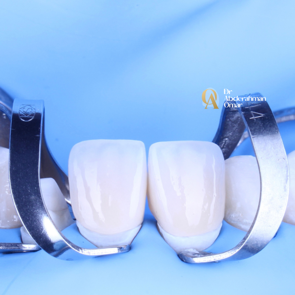 Dr abdelrahman.zip - 85