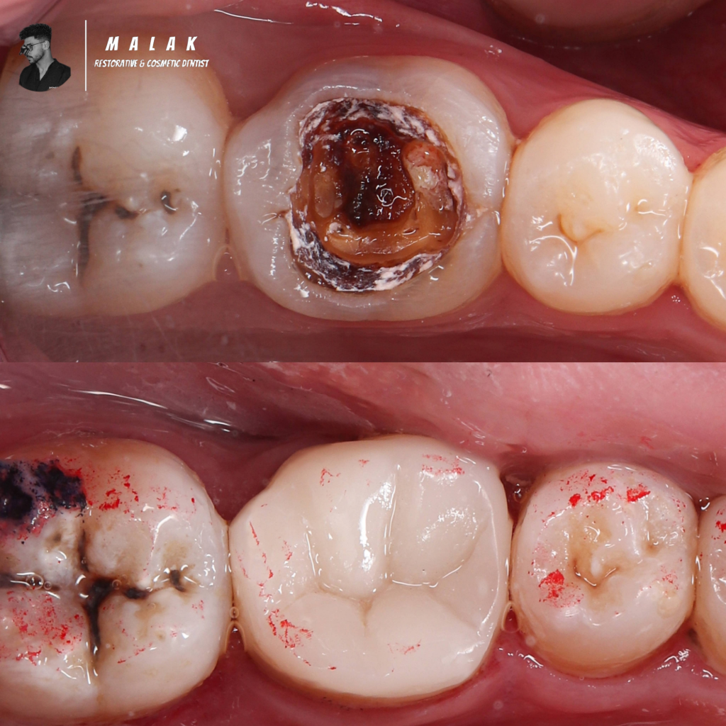 Photoroom-20250505_213220