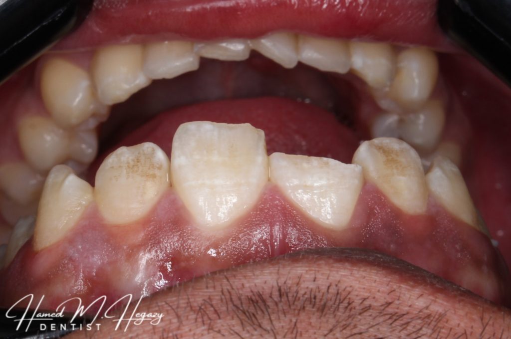 Picsart_25-02-15_15-51-49-372