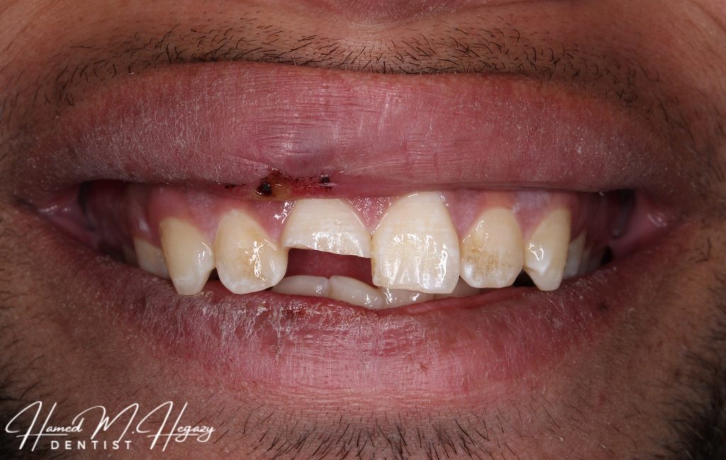 Picsart_25-02-15_15-53-16-050