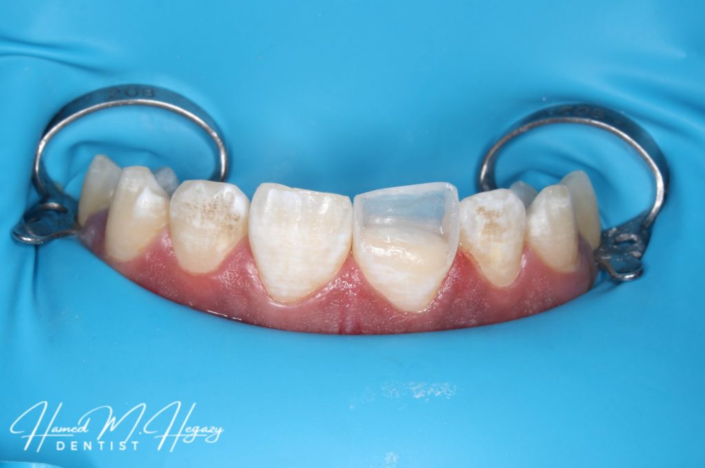 Picsart_25-02-15_15-56-17-968