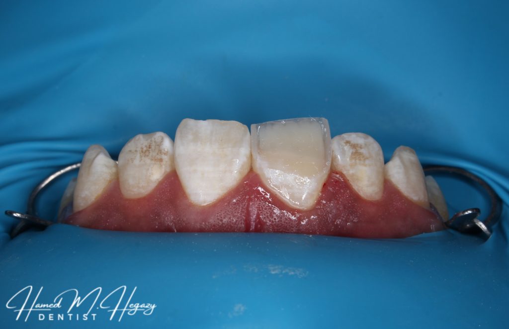 Picsart_25-02-15_16-04-04-926