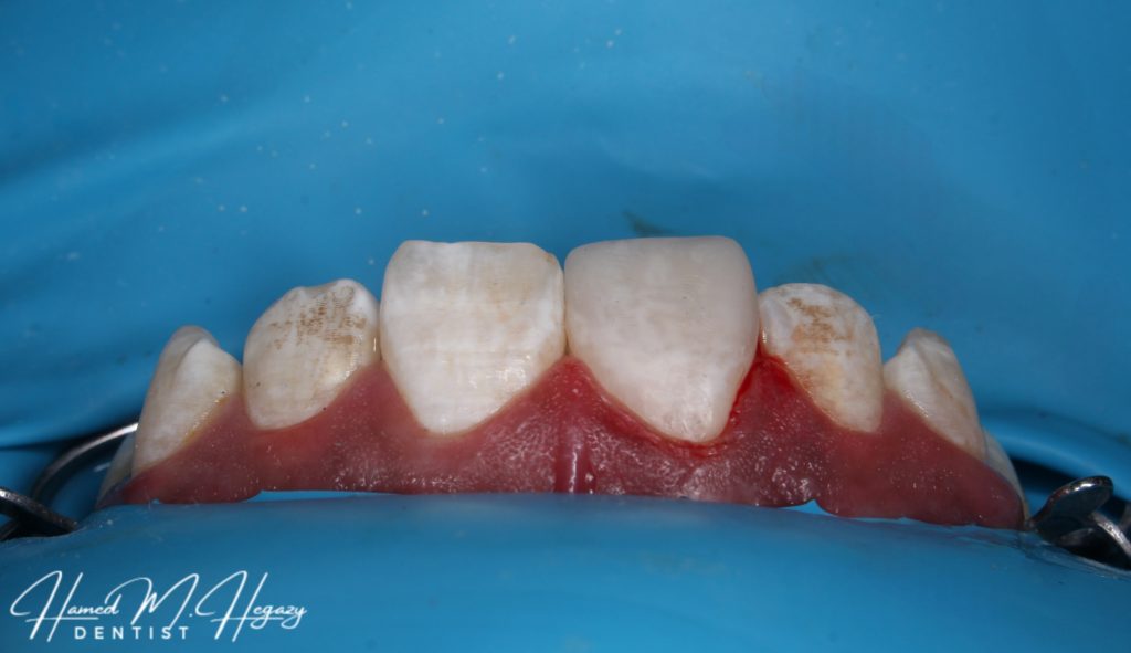 Picsart_25-02-15_16-14-22-907