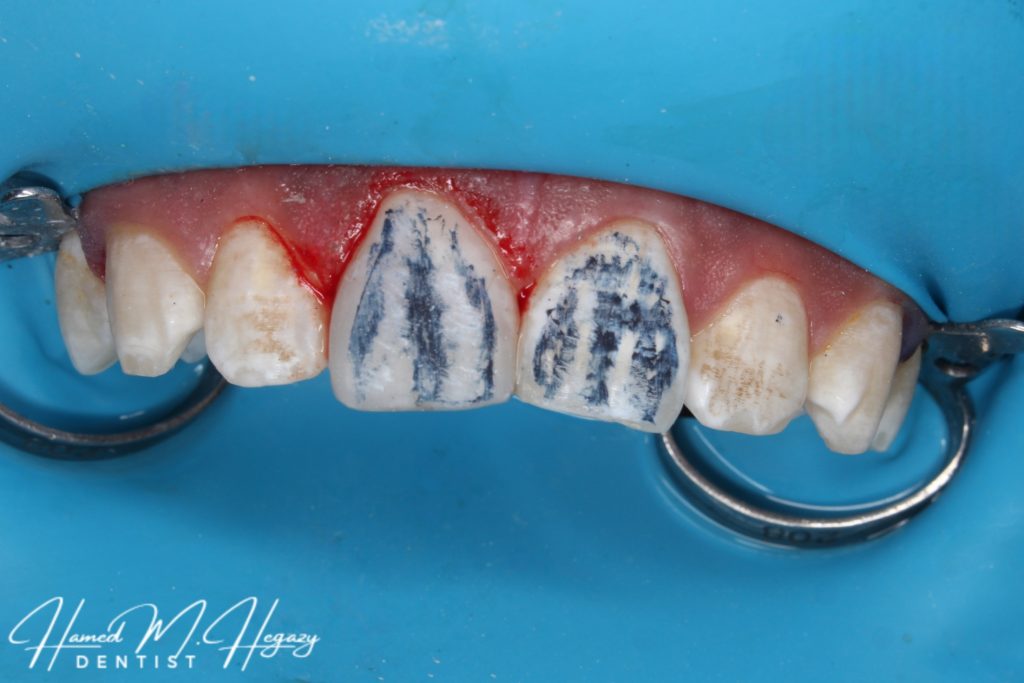 Picsart_25-02-15_16-19-37-598