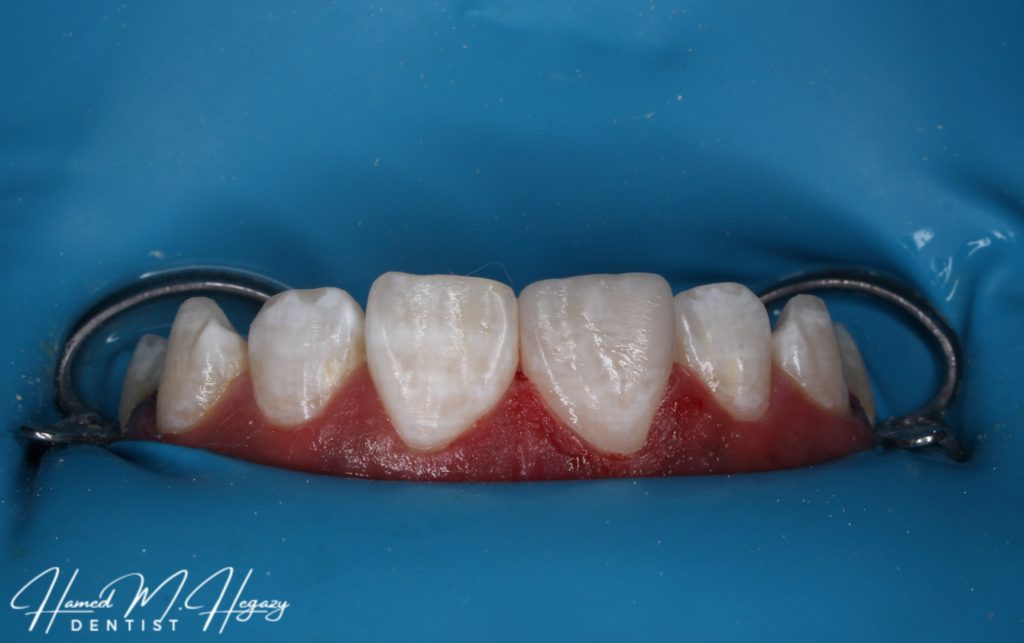 Picsart_25-02-15_16-21-30-479