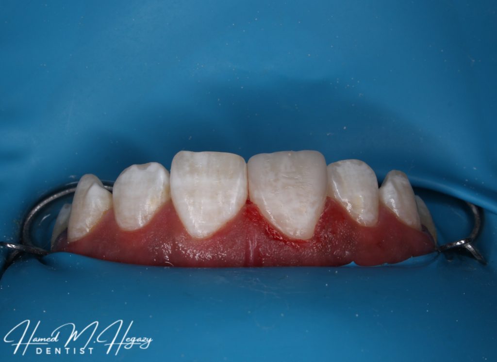 Picsart_25-02-15_16-26-58-610