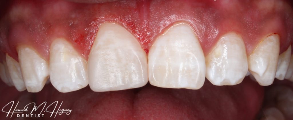 Picsart_25-02-15_16-44-47-316