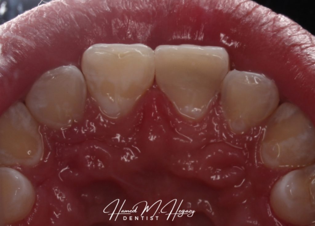 Picsart_25-02-15_16-47-24-482