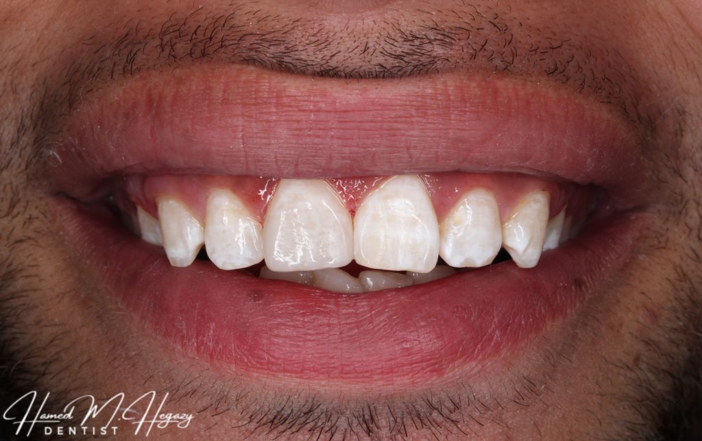 Picsart_25-02-15_16-48-53-048