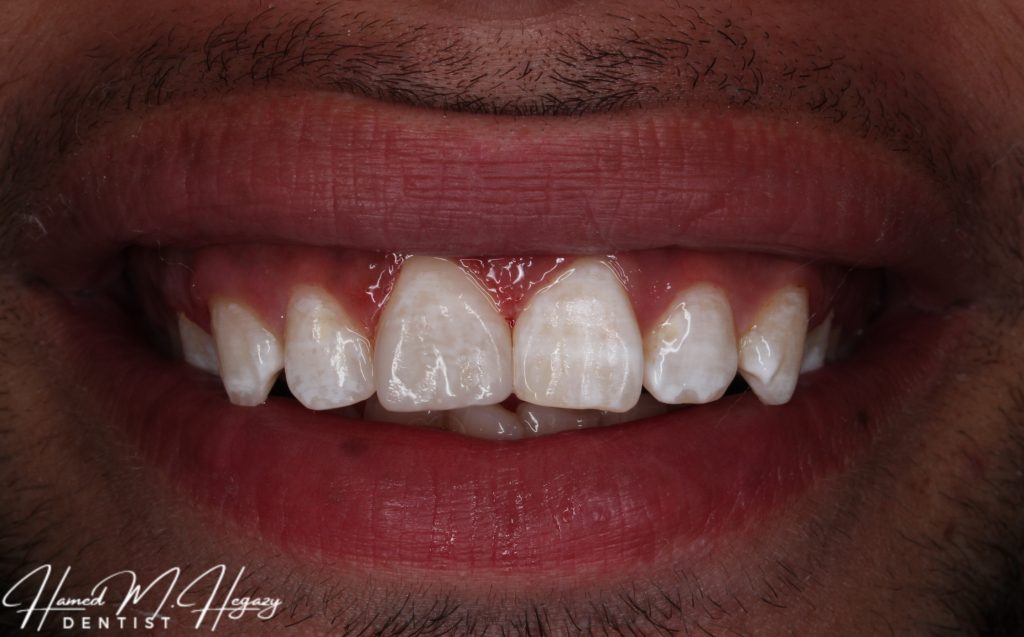 Picsart_25-02-15_16-50-32-720