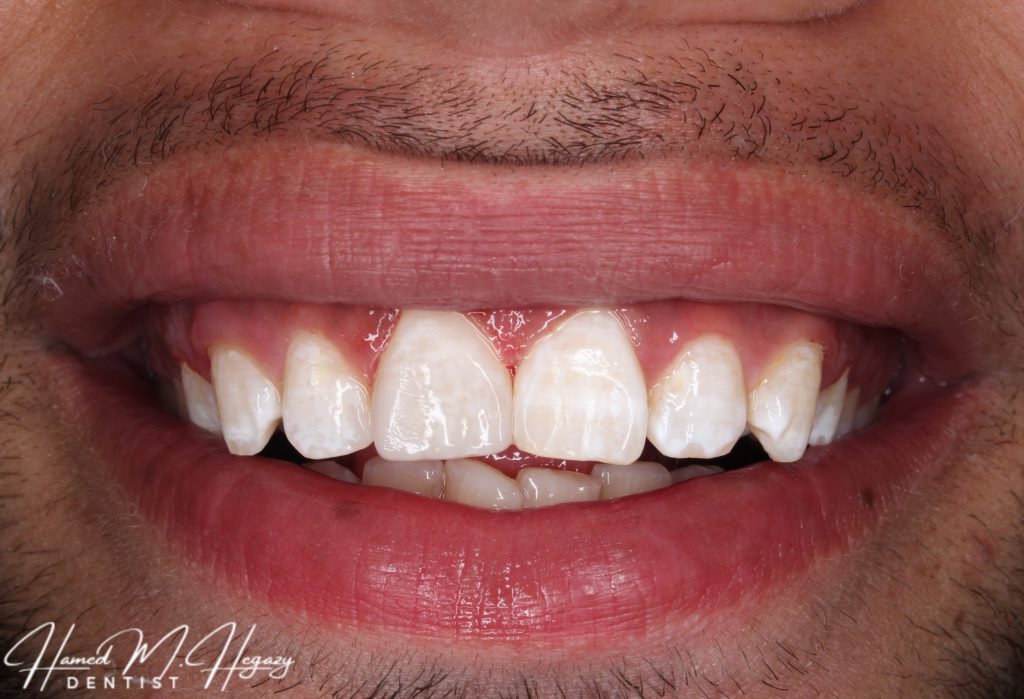 Picsart_25-02-15_16-53-18-181