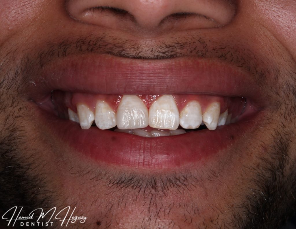 Picsart_25-02-15_16-55-35-285