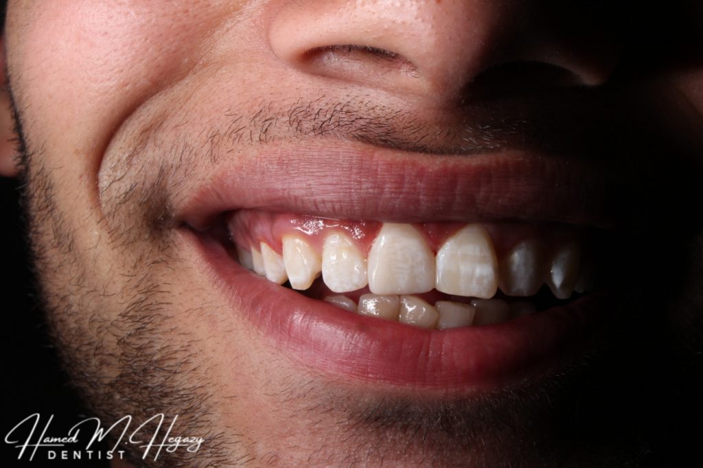 Picsart_25-02-15_17-03-43-391